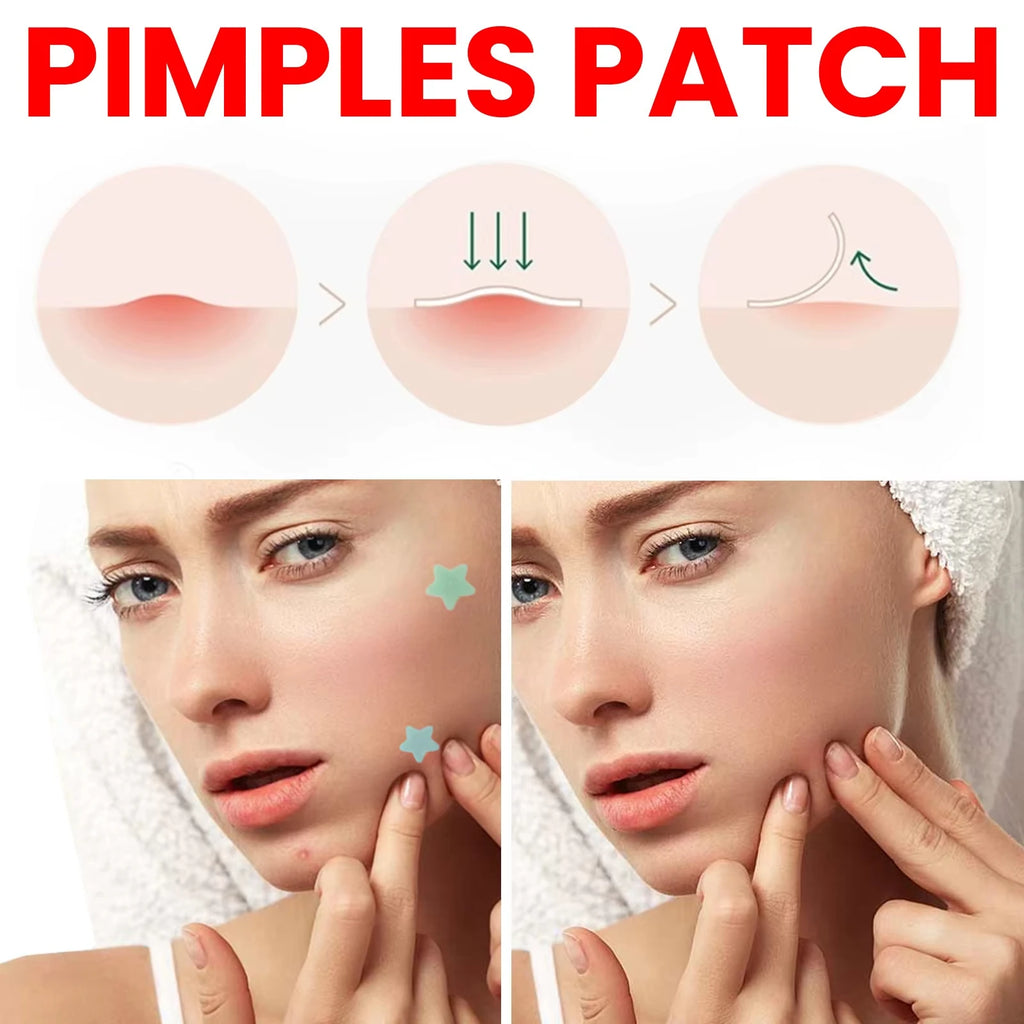 Salicylic Acid Unique Compact Oem Cute Invisible Private Label Custom Design Korean Hydrocolloid Acne Pimple Patches for Face